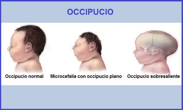 Occipucio-principal.jpg