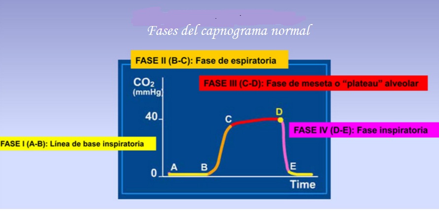 Capnography Capnografía Enallterm