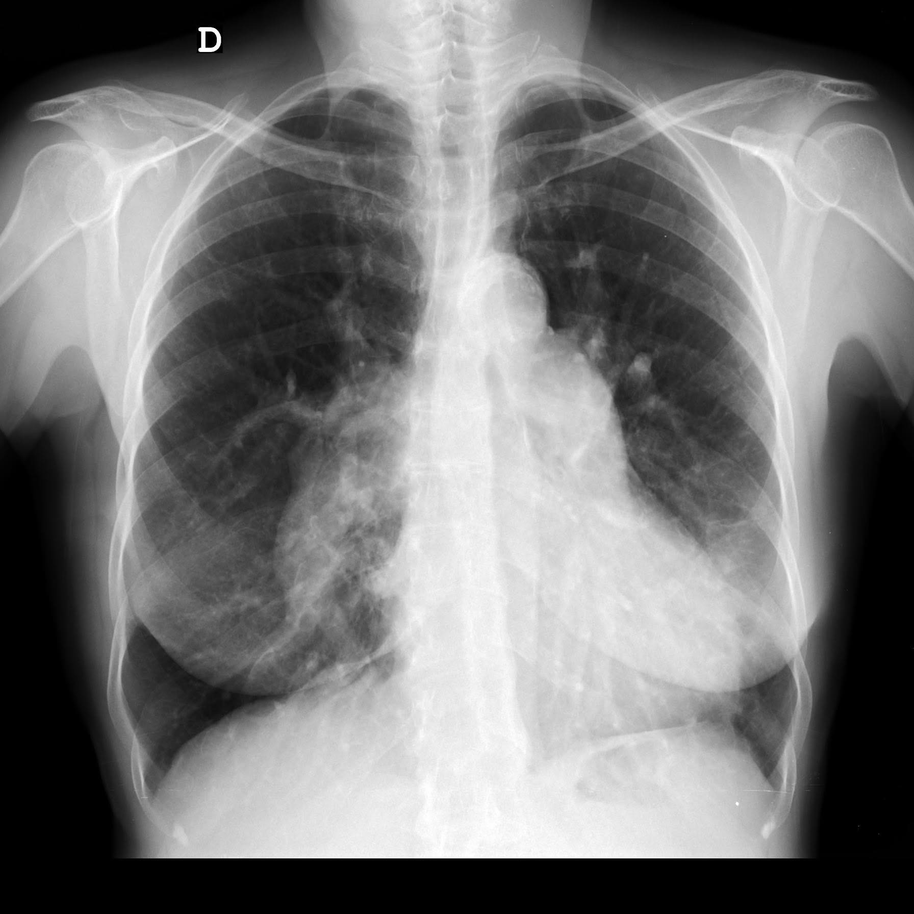 x-ray tórax.jpg