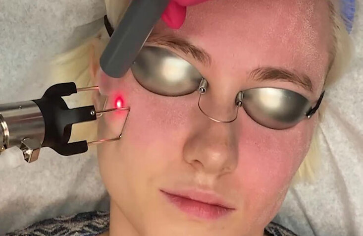 CO2 laser.jpg CO2 laser.jpg